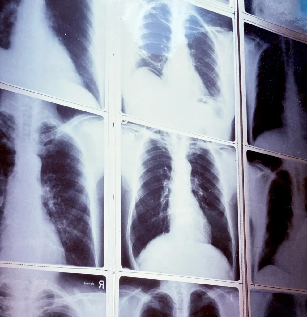 Arbeit Krefelder Lungen von Gerhard Hahn